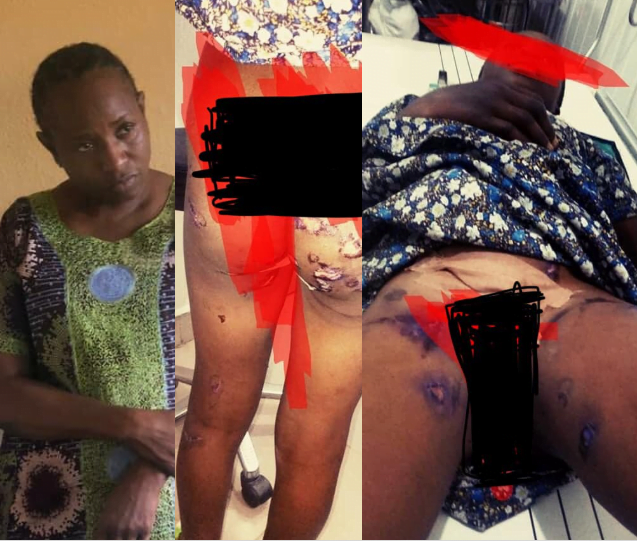Nigerian Deaconess in Police Grip for Burning Girl’s Vital Part with Hot Knife