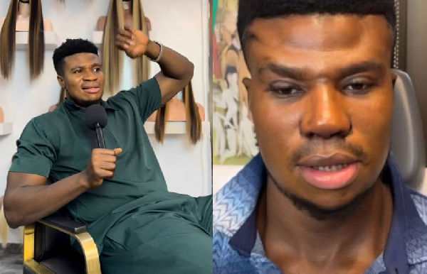 Comedian Zicsaloma’s nose surgery sparks mixed reactions